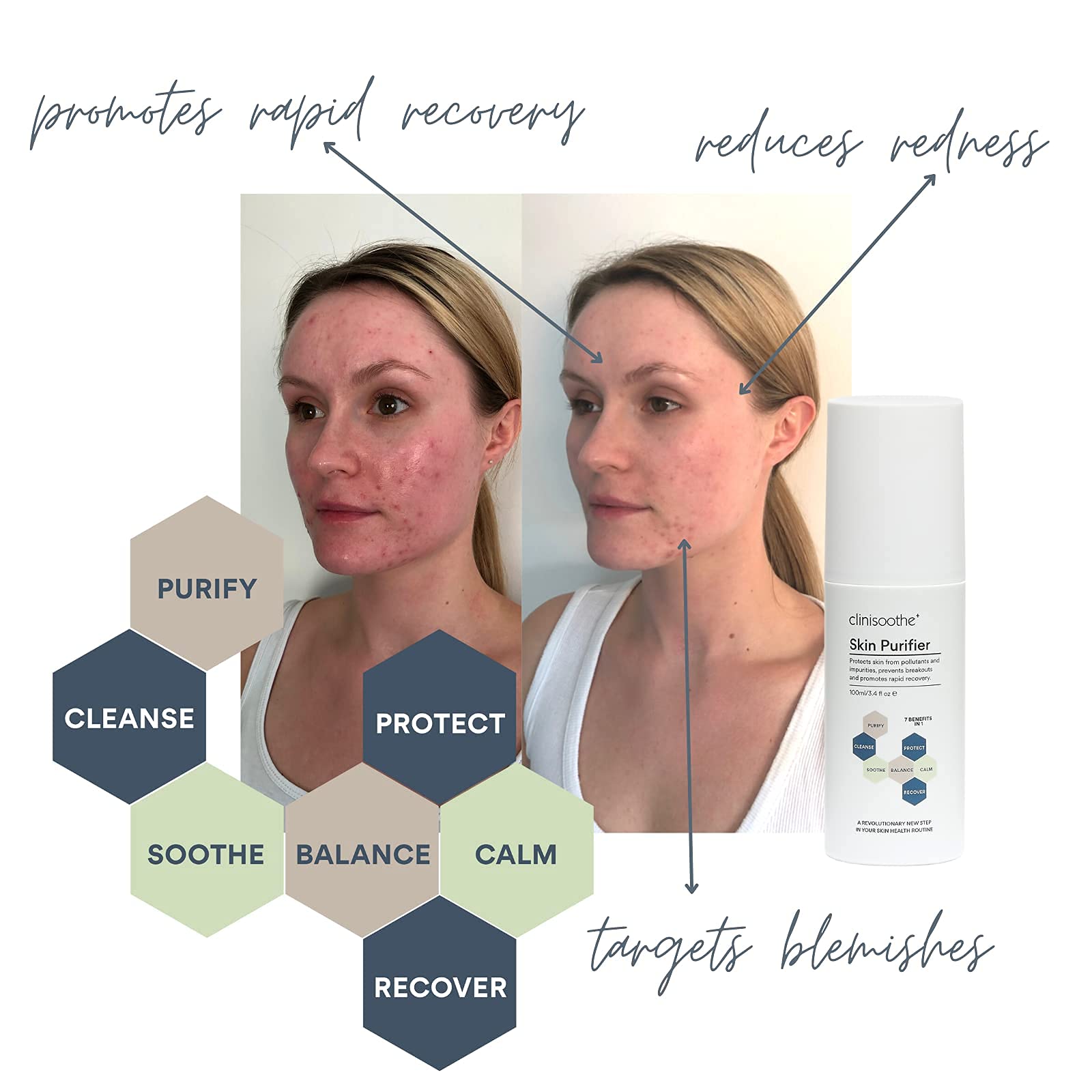 Skin Purifier Spray | Sensitive Skin Care | Antimicrobial Care