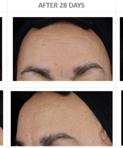 T 10 Face 2